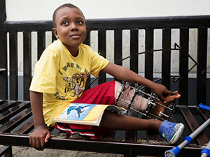 Kenn, an 8-year old boy with L tibla bone deficit due to osteomyelitis. He has had a bone transport procedure to grow two inches of new bone and dock the nonunion site while correcting the deformity.